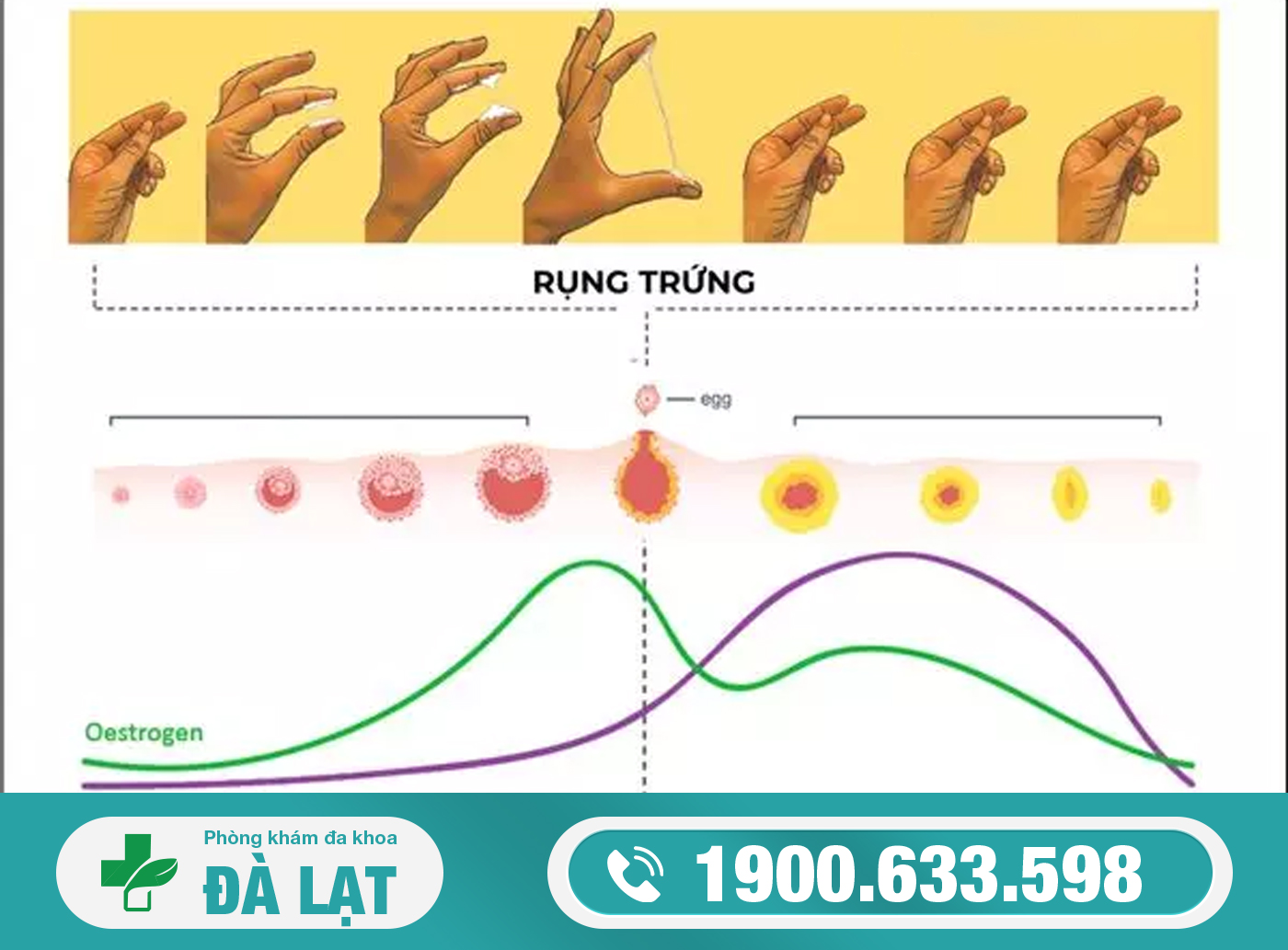 Hình ảnh minh họa